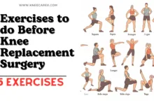 Exercises to do Before Knee Replacement Surgery