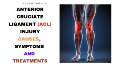 Anterior Cruciate Ligament (ACL) Injury Causes, Symptoms and Treatments