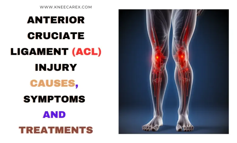 Anterior Cruciate Ligament (ACL) Injury Causes, Symptoms and Treatments