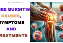 Knee Bursitis Causes, Symptoms and Treatments