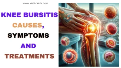 Knee Bursitis Causes, Symptoms and Treatments