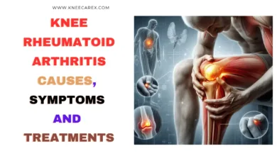 Knee Rheumatoid Arthritis Causes, Symptoms and Treatments