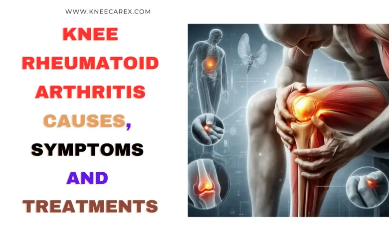 Knee Rheumatoid Arthritis Causes Symptoms And Treatments