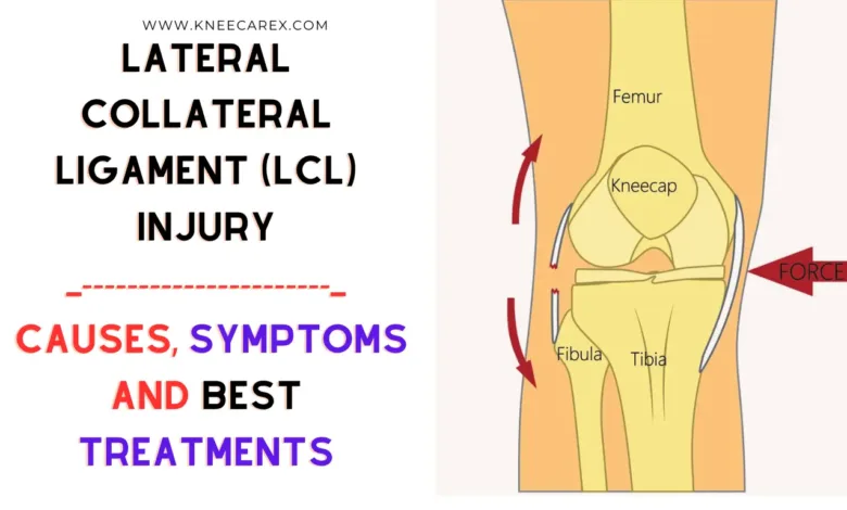 Lateral Collateral Ligament (LCL) Injury Latest Details 2024