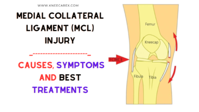 Medial Collateral Ligament (MCL) Injury Causes, Symptoms and Treatments