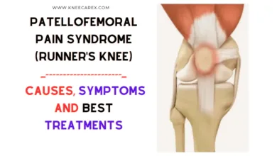 Patellofemoral Pain Syndrome (Runner's Knee) Causes, Symptoms and Treatments