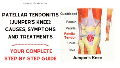 Patellar Tendonitis (Jumper's Knee) Causes, Symptoms and Treatments