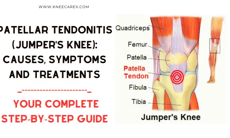 Patellar Tendonitis (Jumper's Knee) Causes, Symptoms and Treatments