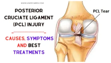 Posterior Cruciate Ligament (PCL) Injury Causes, Symptoms and Treatments