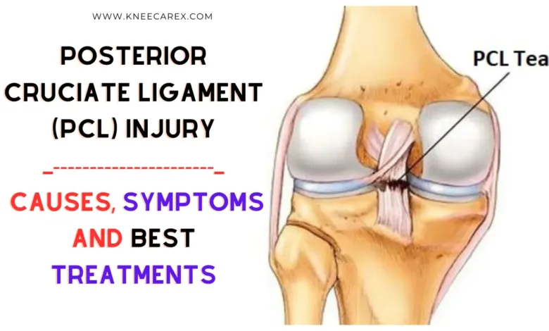 Posterior Cruciate Ligament (PCL) Injury Causes, Symptoms and Treatments