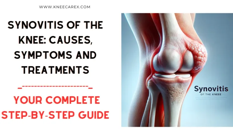 Synovitis of the Knee Causes Symptoms and Treatments