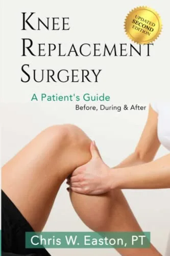 Knee Replacement Surgery Pdf